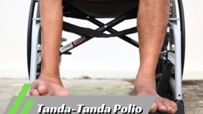 Tanda-Tanda Polio
