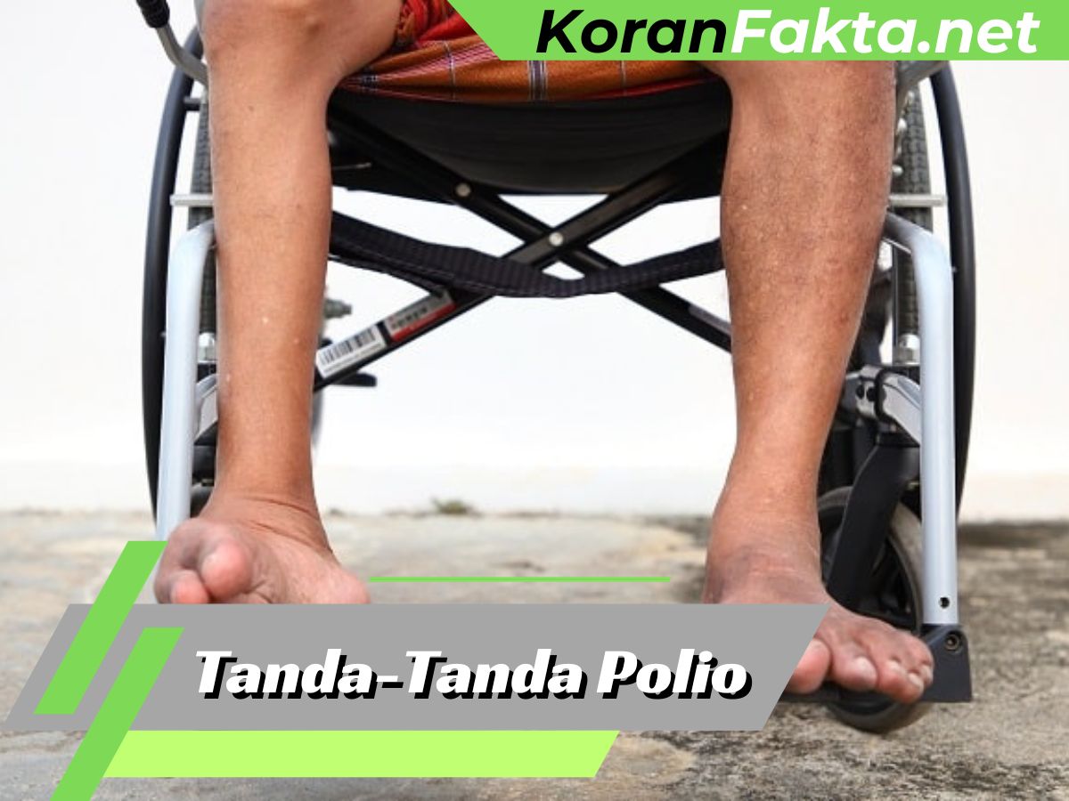 Tanda-Tanda Polio
